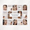 microneedling instagram templates